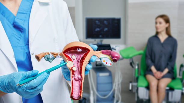 Understanding Pedunculated Fibroids: A Comprehensive Guide